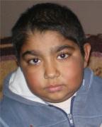Ergin after remedial diet was stopped